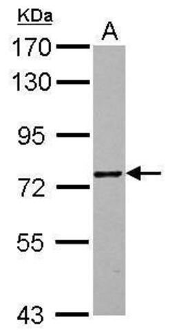 Invitrogen ZNF418 Polyclonal Antibody 100 &mu;L | Buy Online | Invitrogen&trade; | Fisher Scientific