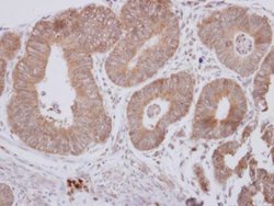 Invitrogen CPEB1 Polyclonal Antibody 100 &mu;L; Unconjugated:Antibodies,