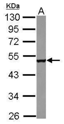 Invitrogen CPEB1 Polyclonal Antibody 100 &mu;L; Unconjugated:Antibodies,