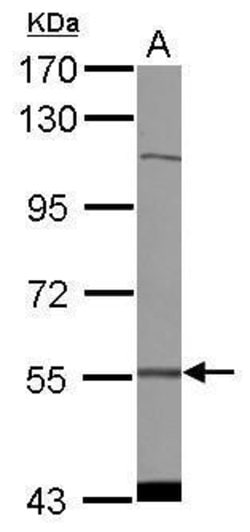 Invitrogen CDADC1 Polyclonal Antibody 100 &mu;L; Unconjugated:Antibodies,