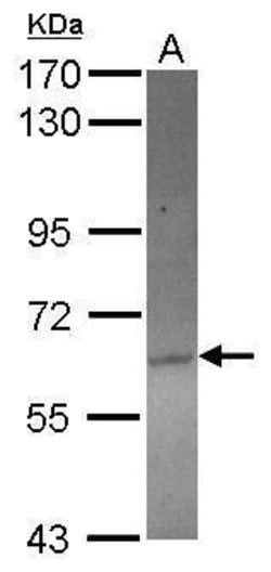 Invitrogen ACOT12 Polyclonal Antibody 100 &mu;L; Unconjugated:Antibodies,
