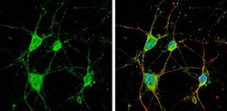 Invitrogen CYFIP1 Polyclonal Antibody 100 &mu;L; Unconjugated:Antibodies,