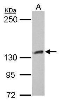 Invitrogen CYFIP1 Polyclonal Antibody 100 &mu;L; Unconjugated:Antibodies,