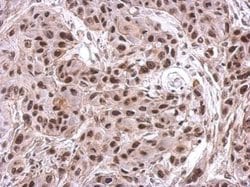 Invitrogen NIP30 Polyclonal Antibody 100 &mu;L; Unconjugated:Antibodies,