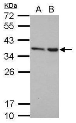 Invitrogen NIP30 Polyclonal Antibody 100 &mu;L; Unconjugated:Antibodies,