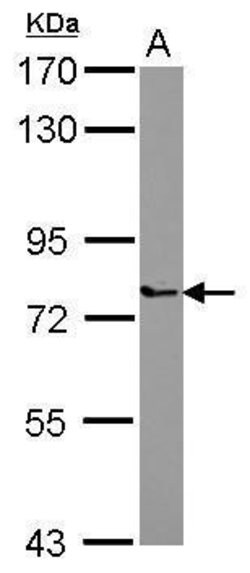 Invitrogen PARP6 Polyclonal Antibody 100 &mu;L; Unconjugated:Antibodies,