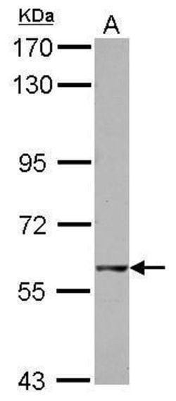 Invitrogen GTPBP2 Polyclonal Antibody 100 &mu;L | Buy Online | Invitrogen&trade; | Fisher Scientific