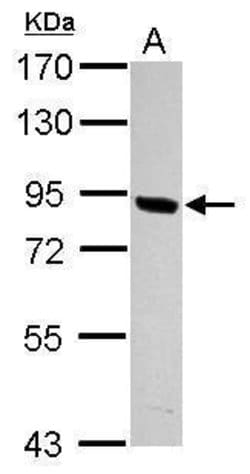 Invitrogen PNPLA8 Polyclonal Antibody 100 &mu;L | Buy Online | Invitrogen&trade; | Fisher Scientific