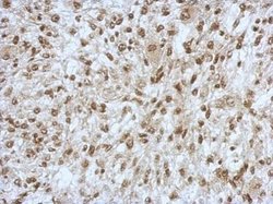 Invitrogen SAP130 Polyclonal Antibody 100 &mu;L | Buy Online | Invitrogen&trade; | Fisher Scientific
