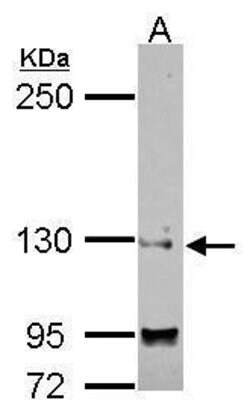 Invitrogen SAP130 Polyclonal Antibody 100 &mu;L | Buy Online | Invitrogen&trade; | Fisher Scientific