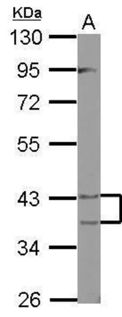 Invitrogen PECI Polyclonal Antibody 100 &mu;L; Unconjugated:Antibodies,