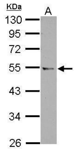 Invitrogen CCDC97 Polyclonal Antibody 100 &mu;L; Unconjugated:Antibodies,