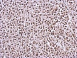 Invitrogen BRMS1L Polyclonal Antibody 100 &mu;L; Unconjugated:Antibodies,
