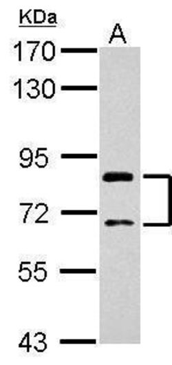 Invitrogen SLCO1C1 Polyclonal Antibody 100 μL; Unconjugated:Antibodies,