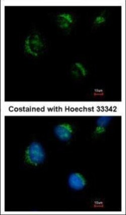 Invitrogen TMEM59L Polyclonal Antibody 100 &mu;L | Buy Online | Invitrogen&trade; | Fisher Scientific