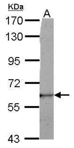 Invitrogen LRRC50 Polyclonal Antibody 100 &mu;L; Unconjugated:Antibodies,