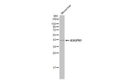 Invitrogen ASGR1 Polyclonal Antibody 100 &mu;L | Buy Online | Invitrogen&trade; | Fisher Scientific