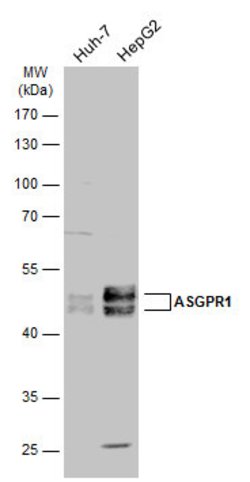 Invitrogen ASGR1 Polyclonal Antibody 100 &mu;L | Buy Online | Invitrogen&trade; | Fisher Scientific