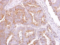 Invitrogen PEPP2 Polyclonal Antibody 100 &mu;L; Unconjugated:Antibodies,