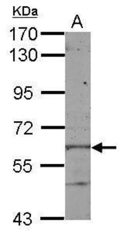 Invitrogen KLHL28 Polyclonal Antibody 100 &mu;L; Unconjugated:Antibodies,