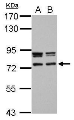 Invitrogen CCDC151 Polyclonal Antibody 100 &mu;L; Unconjugated:Antibodies,