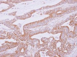 Invitrogen THUMPD2 Polyclonal Antibody 100 &mu;L; Unconjugated:Antibodies,