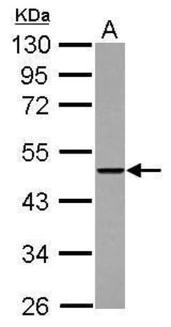 Invitrogen THUMPD2 Polyclonal Antibody 100 &mu;L; Unconjugated:Antibodies,