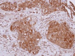 Invitrogen STUB1 Polyclonal Antibody 100 &mu;L; Unconjugated:Antibodies,