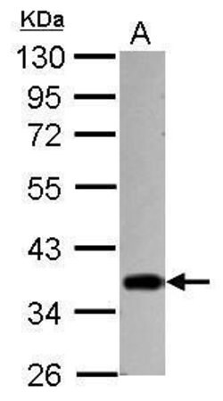 Invitrogen STUB1 Polyclonal Antibody 100 &mu;L; Unconjugated:Antibodies,