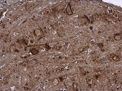 Invitrogen LCMT2 Polyclonal Antibody 100 &mu;L; Unconjugated:Antibodies,