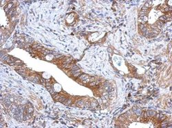 Invitrogen GCNT3 Polyclonal Antibody 100 &mu;L; Unconjugated:Antibodies,