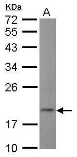 Invitrogen NT5C Polyclonal Antibody 100 &mu;L; Unconjugated:Antibodies,