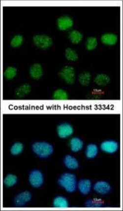 Invitrogen ZNF597 Polyclonal Antibody 100 &mu;L; Unconjugated:Antibodies,