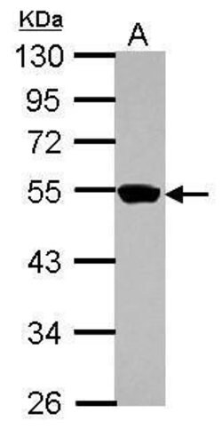 Invitrogen ZNF597 Polyclonal Antibody 100 &mu;L; Unconjugated:Antibodies,