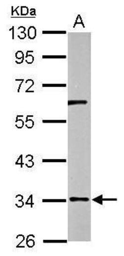 Invitrogen RPUSD3 Polyclonal Antibody 100 &mu;L; Unconjugated:Antibodies,