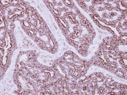Invitrogen HIBADH Polyclonal Antibody 100 &mu;L | Buy Online | Invitrogen&trade; | Fisher Scientific