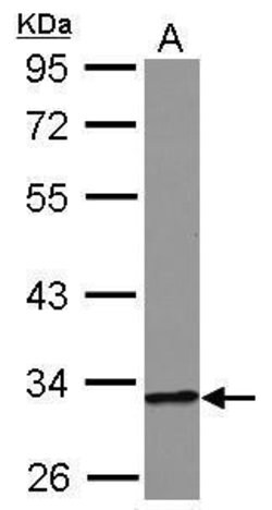 Invitrogen HIBADH Polyclonal Antibody 100 &mu;L | Buy Online | Invitrogen&trade; | Fisher Scientific