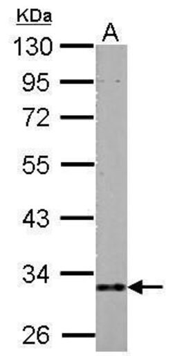 Invitrogen HIBADH Polyclonal Antibody 100 &mu;L | Buy Online | Invitrogen&trade; | Fisher Scientific