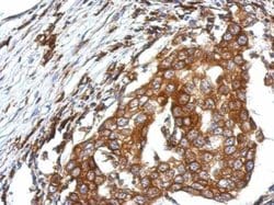 Invitrogen QTRTD1 Polyclonal Antibody 100 μL; Unconjugated:Antibodies,