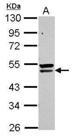 Invitrogen QTRTD1 Polyclonal Antibody 100 μL; Unconjugated:Antibodies,
