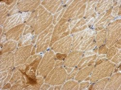 Invitrogen ANKRD53 Polyclonal Antibody 100 &mu;L; Unconjugated:Antibodies,