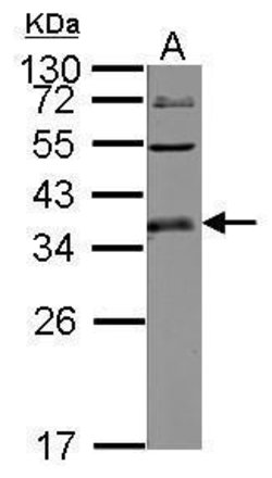 Invitrogen ULBP1 Polyclonal Antibody 100 &mu;L | Buy Online | Invitrogen&trade; | Fisher Scientific