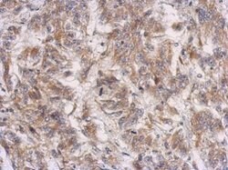 Invitrogen PRSS35 Polyclonal Antibody 100 μL; Unconjugated:Antibodies,
