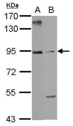 Invitrogen ARMC3 Polyclonal Antibody 100 &mu;L; Unconjugated:Antibodies,