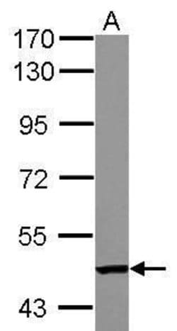 Invitrogen TC2N Polyclonal Antibody 100 &mu;L; Unconjugated:Antibodies,
