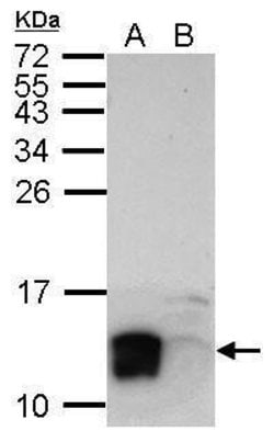 Invitrogen LYPD6 Polyclonal Antibody 100 &mu;L; Unconjugated:Antibodies,