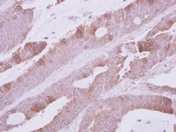 Invitrogen Atpalpha Polyclonal Antibody 100 &mu;L; Unconjugated:Antibodies,