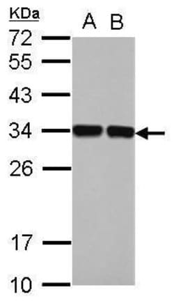 Invitrogen ENOPH1 Polyclonal Antibody 100 &mu;L; Unconjugated:Antibodies,