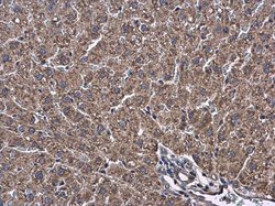 Invitrogen ATL3 Polyclonal Antibody 100 &mu;L | Buy Online | Invitrogen&trade; | Fisher Scientific