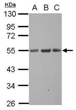 Invitrogen SYT13 Polyclonal Antibody 100 &mu;L | Buy Online | Invitrogen&trade; | Fisher Scientific